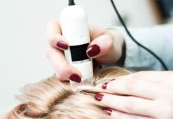 As doenças mais comuns do couro cabeludo. Causas e tipos
